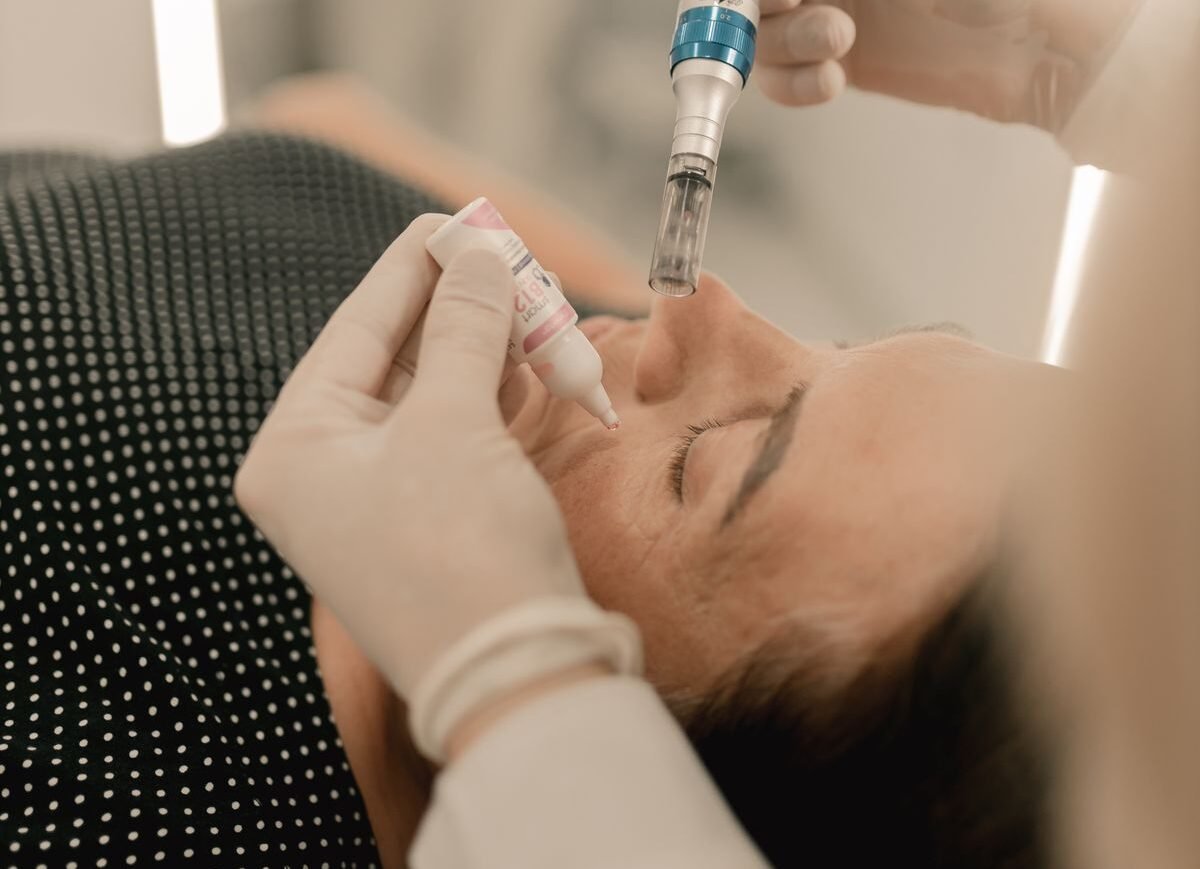 dermapen-microneedling